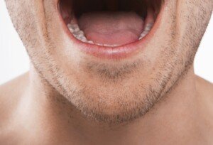 Can GERD Cause ONLY Excess Saliva?