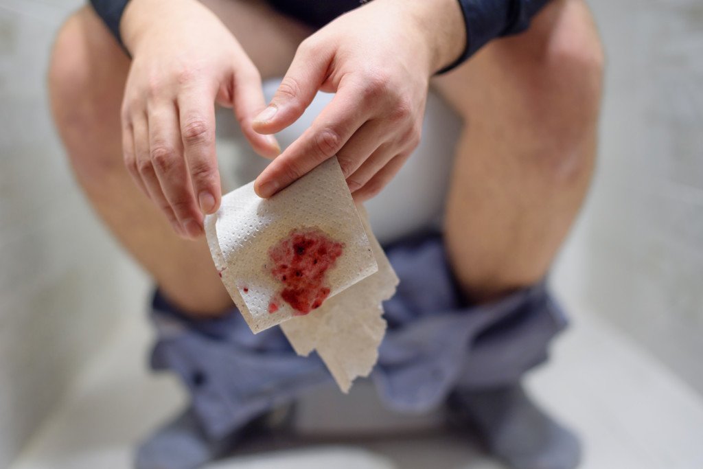 Blood On Toilet Paper Wiping Too Hard at Hector Tuttle blog