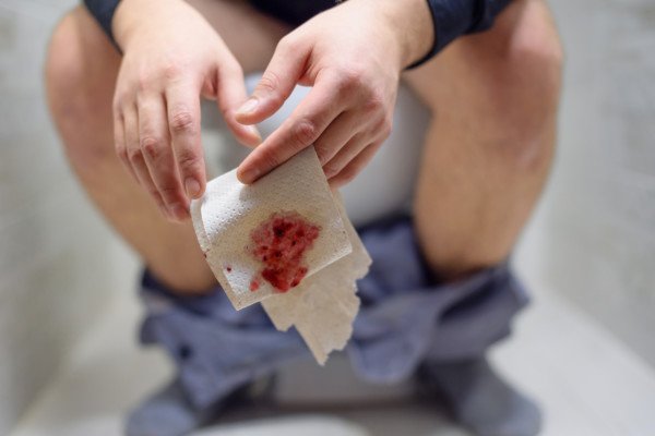 what-can-blood-on-toilet-paper-but-not-on-stool-mean-scary-symptoms