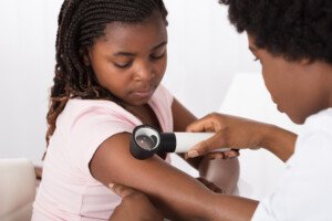How Rare Is Melanoma in Dark Skinned Children?