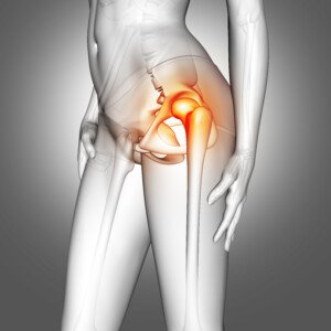 ovarian cancer hip pain