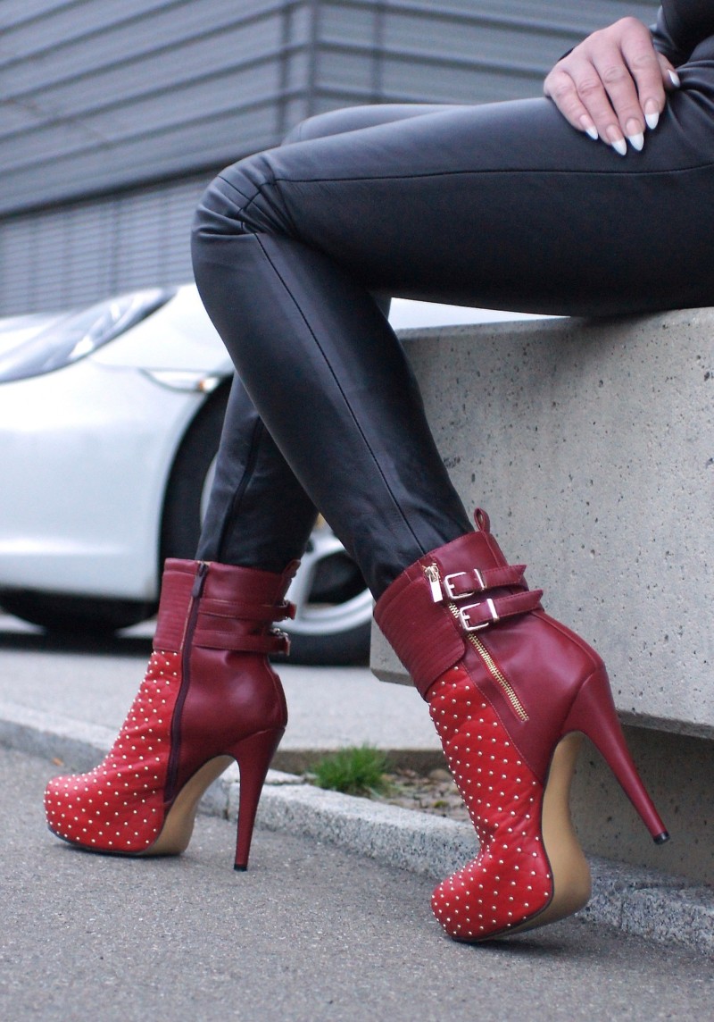 Can Tight Shoes Cause Permanent Peripheral Neuropathy? » Scary Symptoms