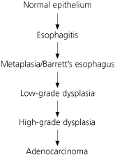 barrett's esophagus progression