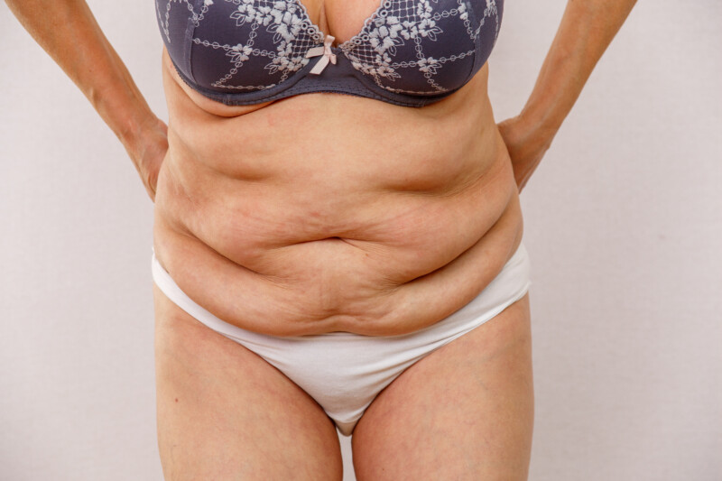 Recent Belly Weight Gain Ovarian Cancer or Normal Aging? » Scary Symptoms