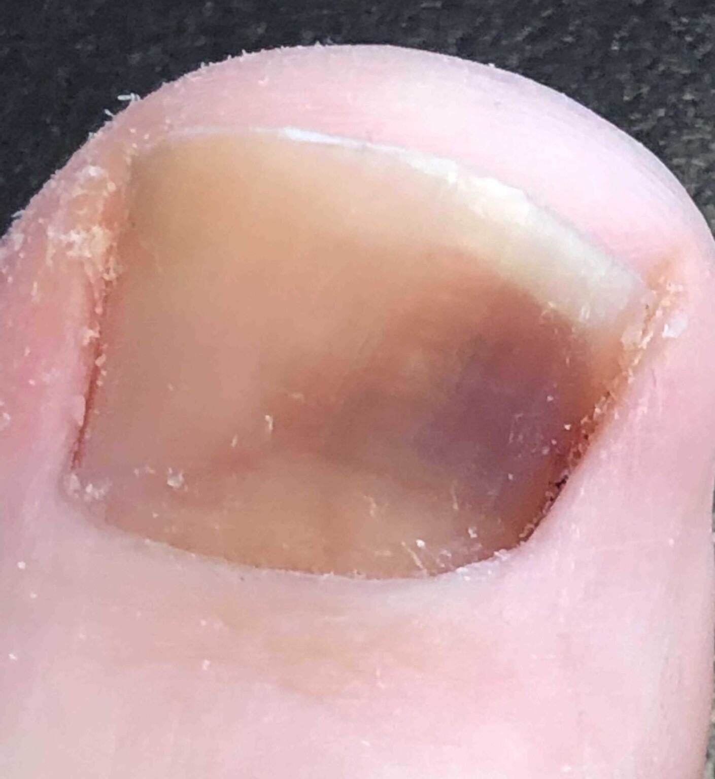Vulvar Hematoma Healing: When To See A Doctor - az9zgkw