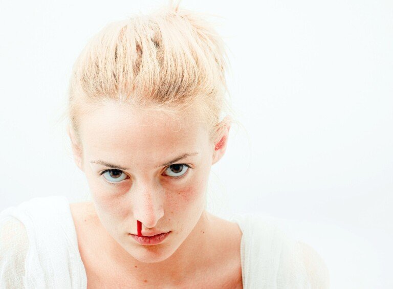 Are Unexplained Nosebleeds A Sign Of Future Brain Aneurysm Scary Symptoms