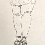 Why Does Morbid Obesity Make Knees Look Backwards?