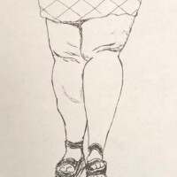 Why Does Morbid Obesity Make Knees Look Backwards?